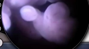 ГРЕХ ДЕТОУБИЙСТВА слова Оксаны Москаленко, музыка Павла Иволгина