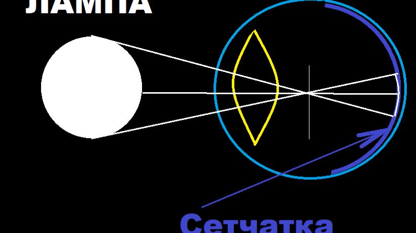 Шарообразный ГЛАЗ. Центральная фиксация оптических осей. Активизация нервных клеток СЕТЧАТКИ! смотреть онлайн
