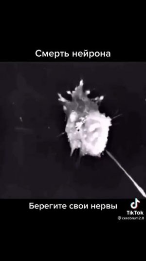 383.Смерть нейрона