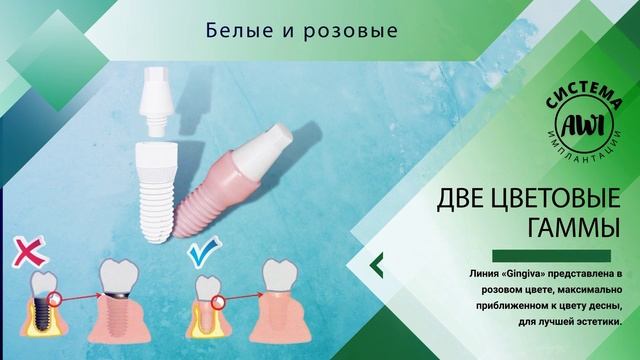 Премиальные имплантаты AWI
