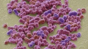 Azotobacter chroococcum