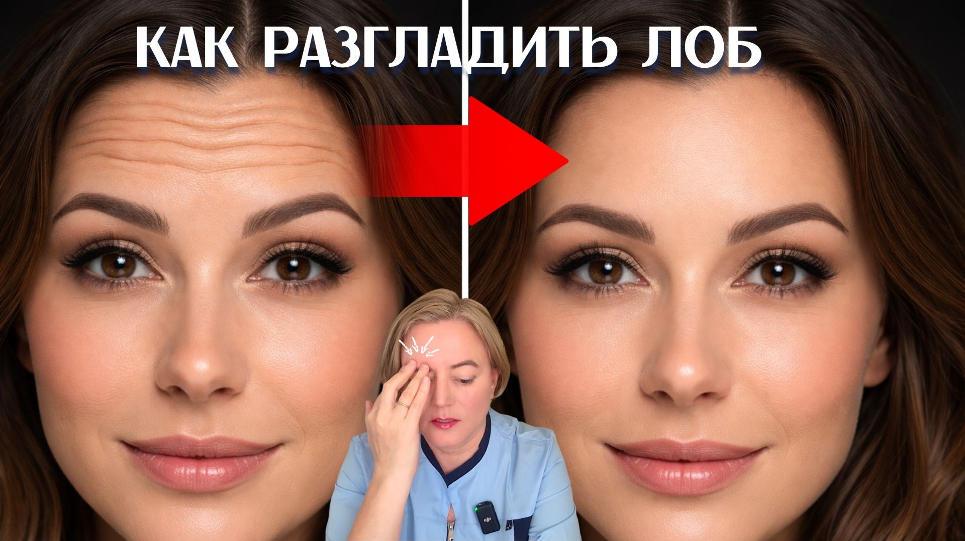 Новое Упражнение от Морщин на Лбу в 40-65 лет Убираются за 2 Минуты смотреть онлайн