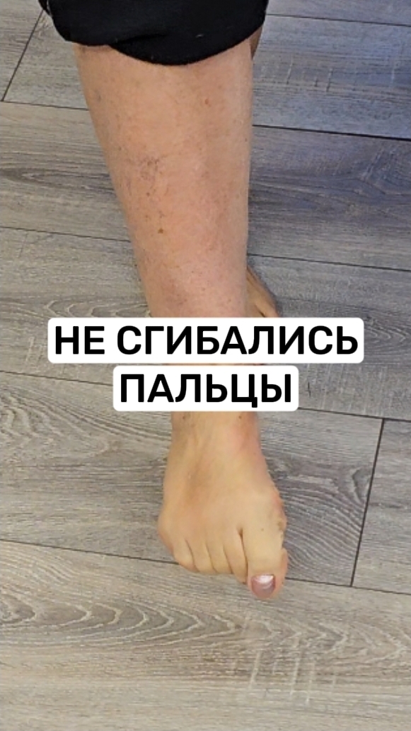 Поставили пятку на место, убрали зажимы в икре и стопе и пальцы заработали смотреть онлайн