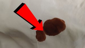 Как удалить йод с одежды За 3 Секунды.!!!!!!!!