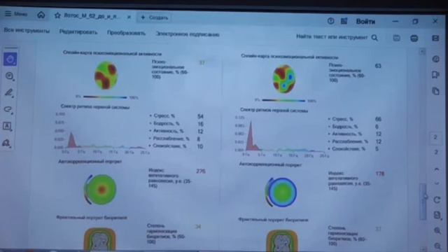 Все показатели улучшаются за один день🔥🔥🔥🔥🔥 Так работает фуллерен💪💯💜 смотреть онлайн