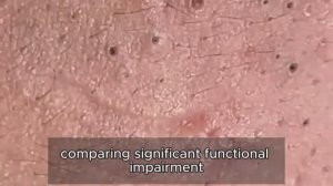 Глубокое очищение кожи от прыщей без скрабирования. #𝟗𝟎528