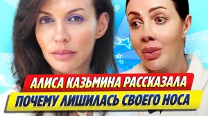 Казьмина объяснила, почему лишилась носа 🔥 Новости Шоу-Бизнеса