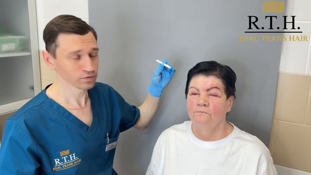 Сложный случай — результат уже через сутки! смотреть онлайн