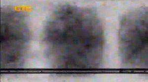 Профилактика на телеканале «СТС» (2013)