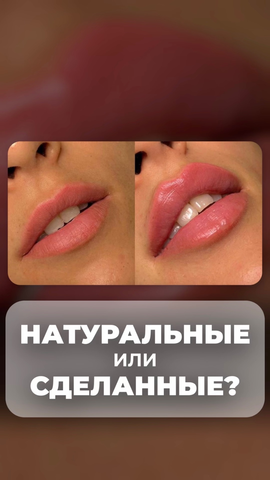 Проводила социальный опрос – натуральные или сделанные? смотреть онлайн