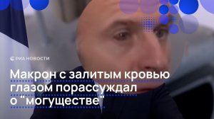 Макрон с залитым кровью глазом порассуждал о "могуществе"