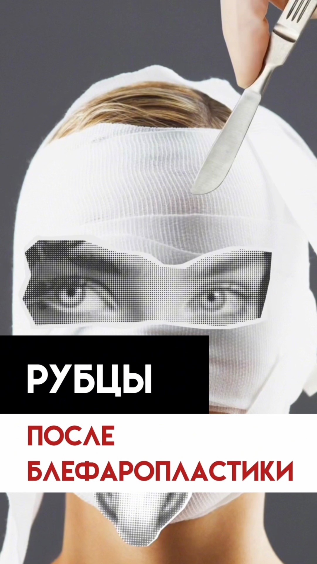 Рубцы после пластики. Стоит бояться? смотреть онлайн