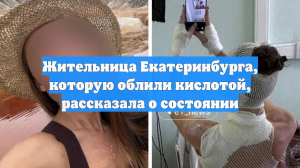 Жительница Екатеринбурга, которую облили кислотой, рассказала о состоянии