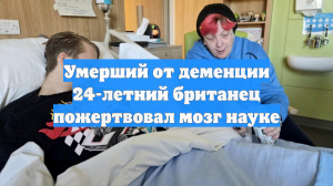 Умерший от деменции 24-летний британец пожертвовал мозг науке