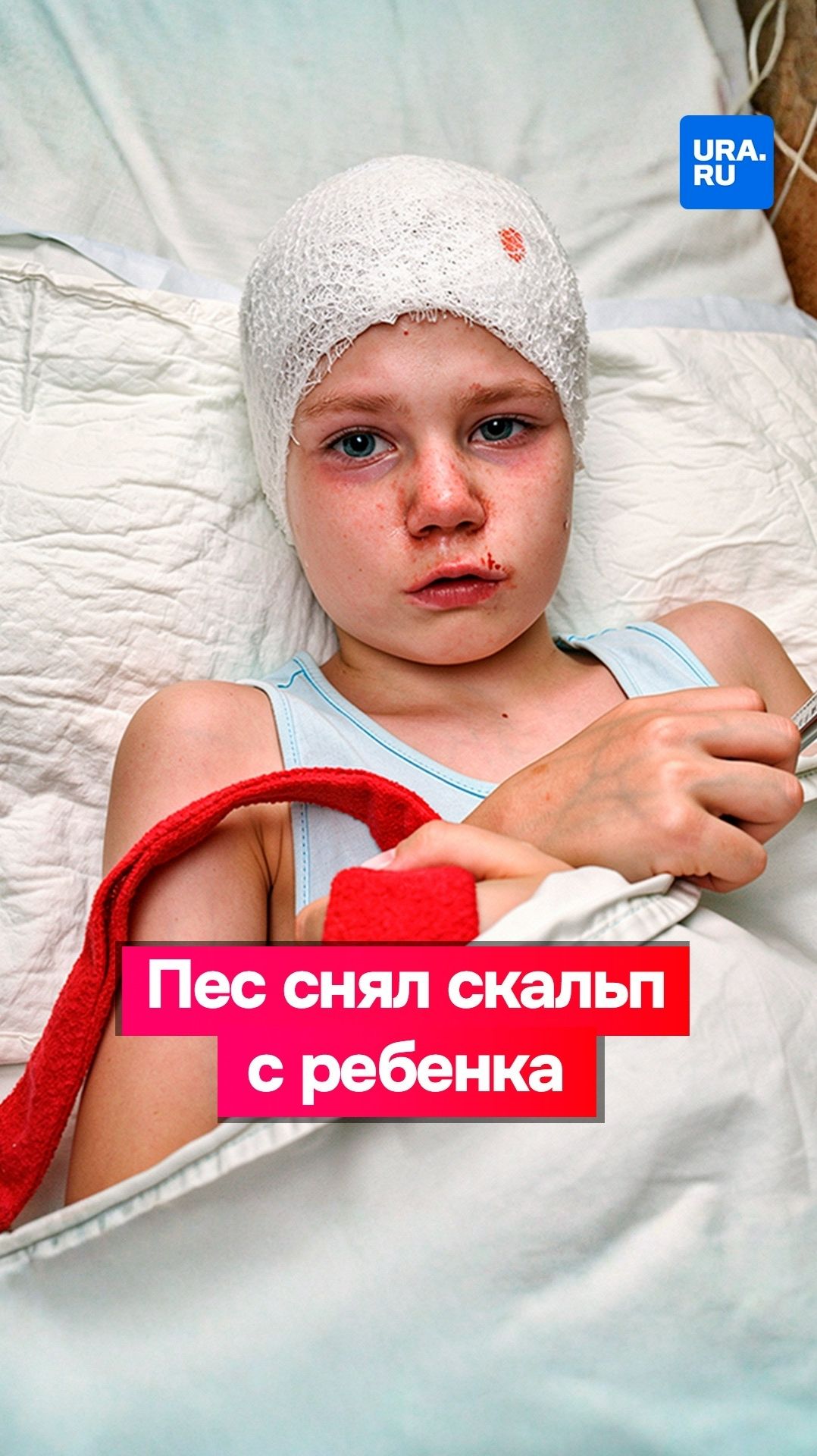 Пес снял скальп со школьницы в Хакасии смотреть онлайн