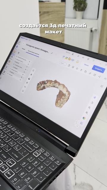 3D сканирование в стоматологии / Используют при установке коронок и имплантов, лечении на элайнерах смотреть онлайн