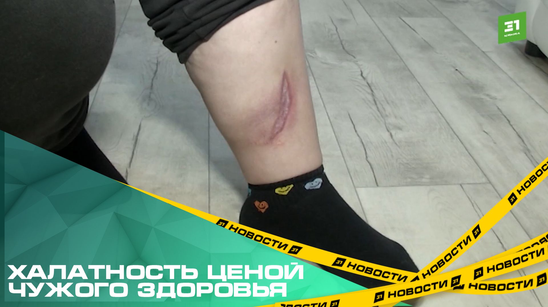 Халатность ценой чужого здоровья. Челябинка, упавшая в колодец, добивается наказания для виновных смотреть онлайн