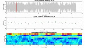 Сжатие речи. Стандарт GSM