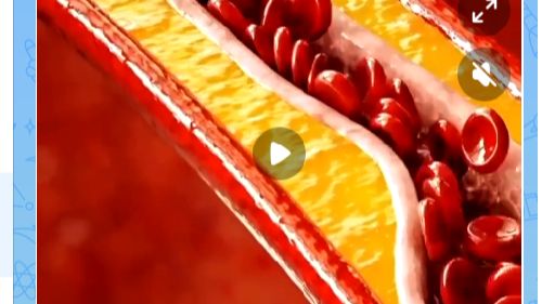 Жизнь и ПРОЗРЕНИЕ. Мигание через 1 удар сердца. Господи помилуй. 2 цветных звезды Симменса! смотреть онлайн