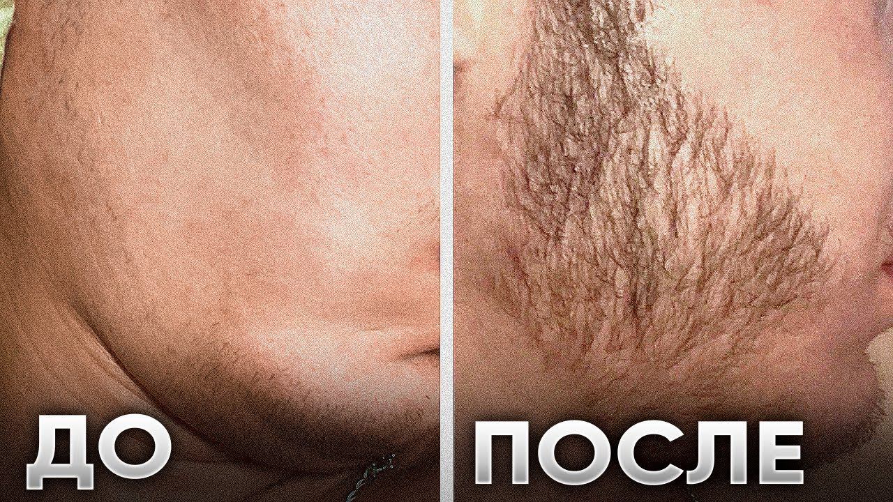 Что будет, если использовать Ксиноксин, Mr. Volos и Киркланд? Результаты средств для роста бороды смотреть онлайн