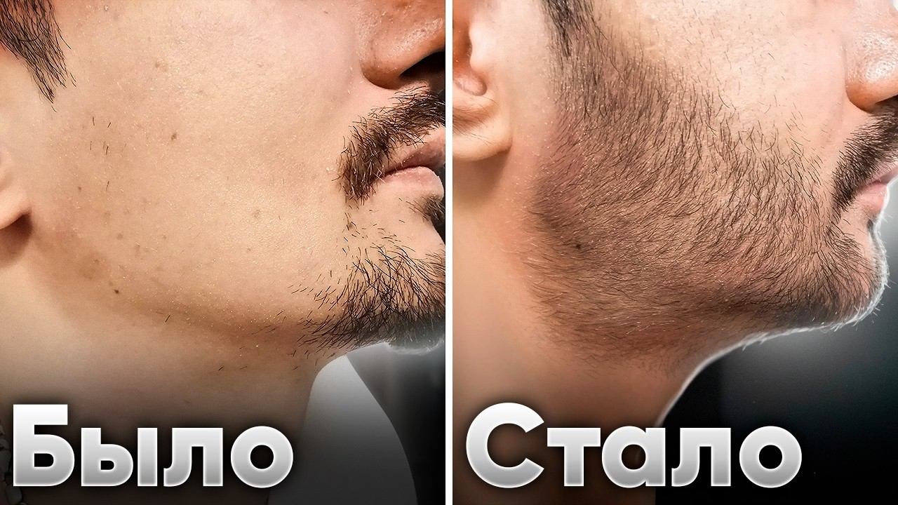 БОРОДА ЗА 3 МЕСЯЦА! Результаты от применения Mr. Volos смотреть онлайн