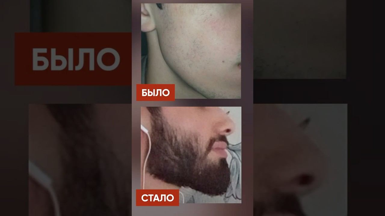 Борода как у Царя Леонида за 4 месяца! смотреть онлайн