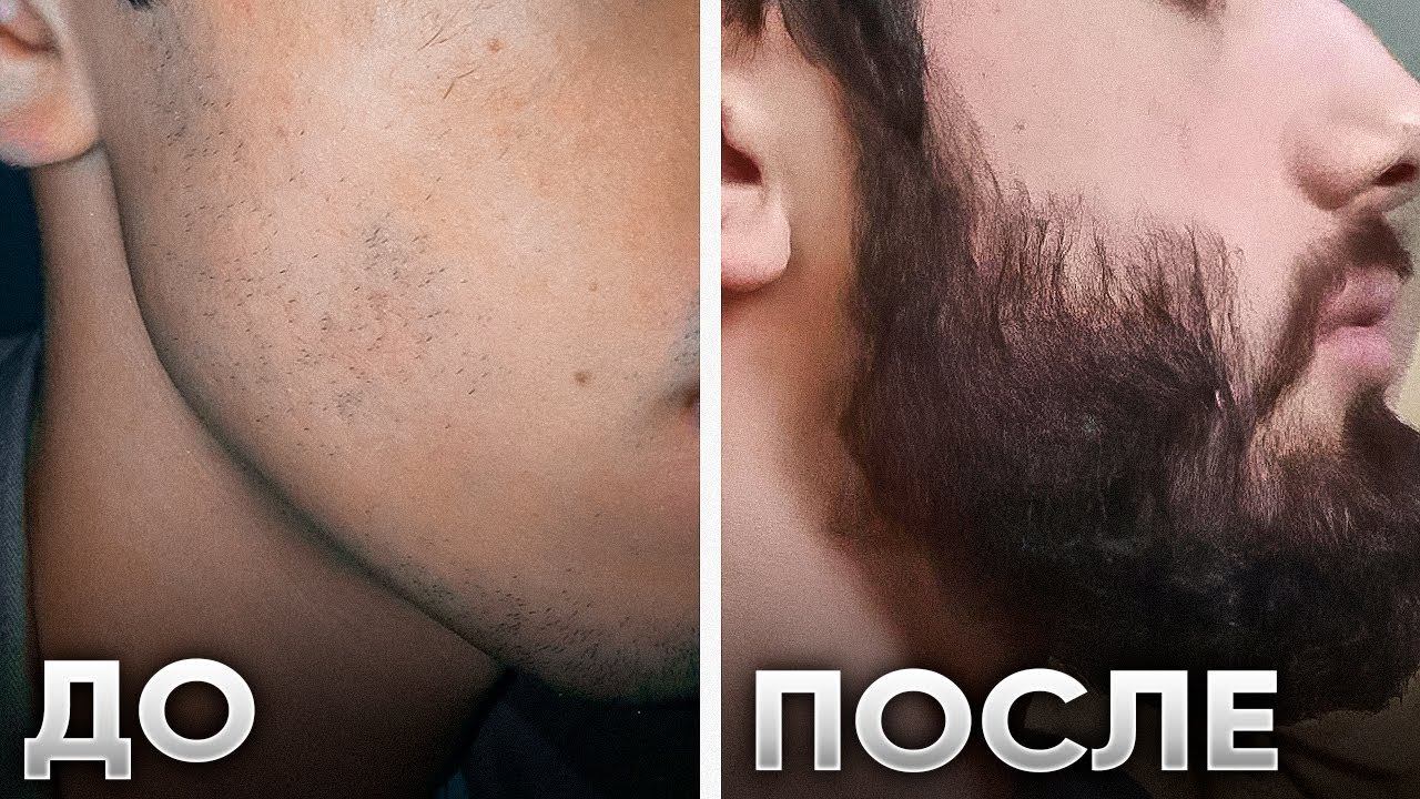 Отрастил бороду как у СПАРТАНЦА за 4 месяца / результаты Киркланд смотреть онлайн