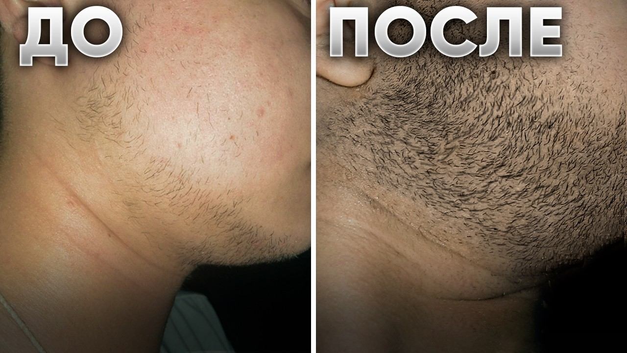 РЕЗУЛЬТАТ Mr.Volos: Борода с нуля за 5 месяцев смотреть онлайн