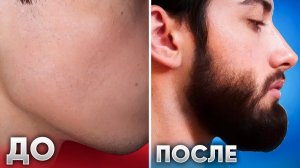 Густая борода за 4 месяца! И только одно средство — Киркланд