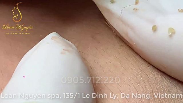 СТРАННЫЕ ШТУКИ_черные точки. Зрелище для ценителей смотреть онлайн