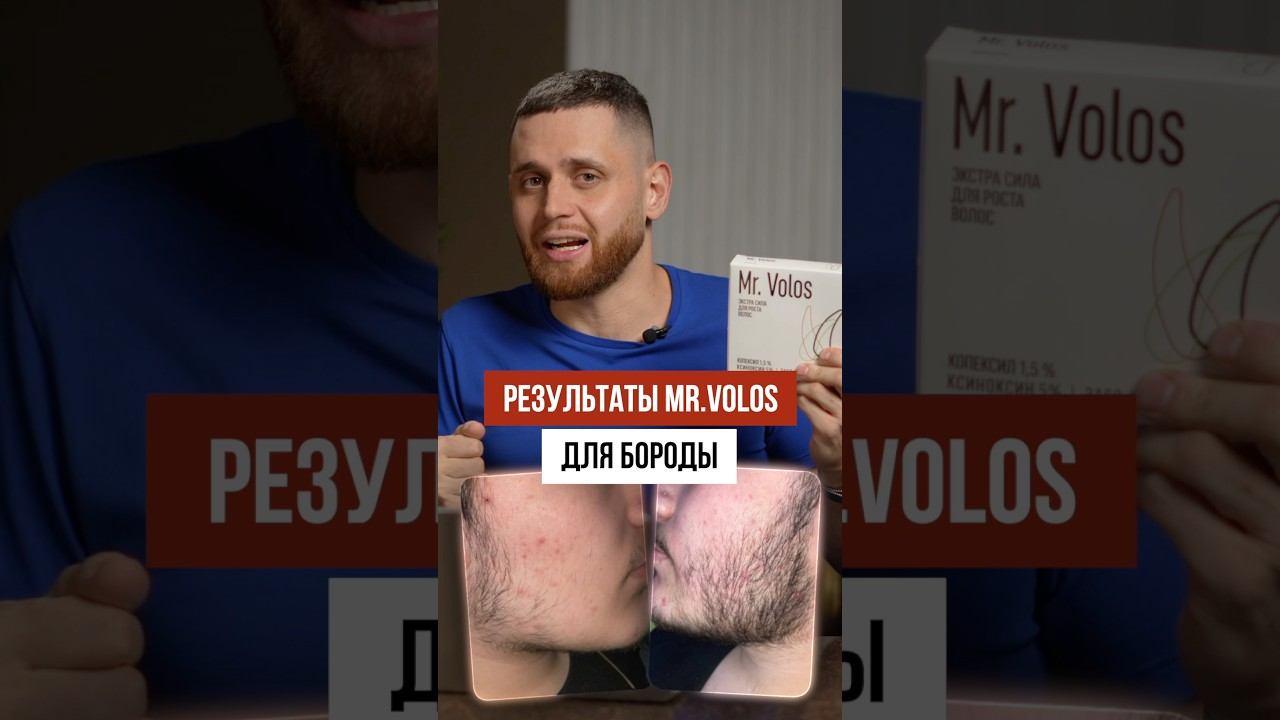 В 16 запустил рост бороды с помощью… смотреть онлайн