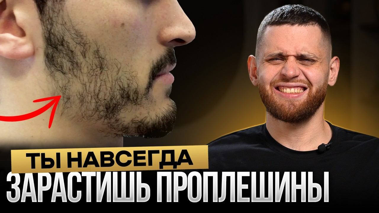 10 советов как зарастить проплешины и сделать бороду густой смотреть онлайн