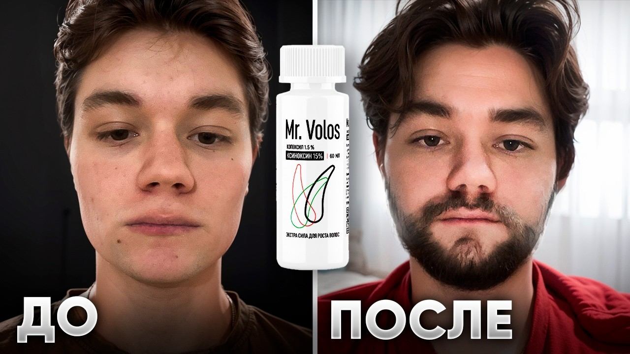 ОТРАСТИЛ БОРОДУ ЛЕСНИКА с НУЛЯ. Результаты применения Mr.VOLOS 5% и 15% смотреть онлайн