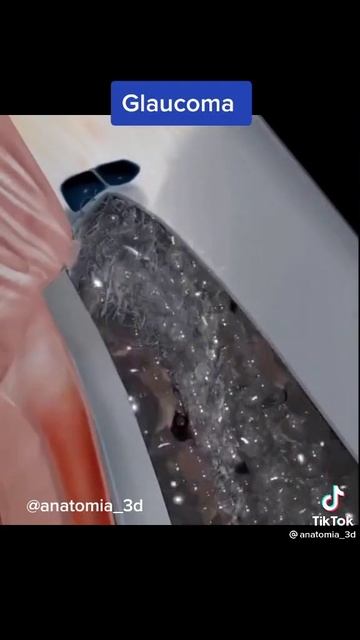 1000.Человеческий глаз