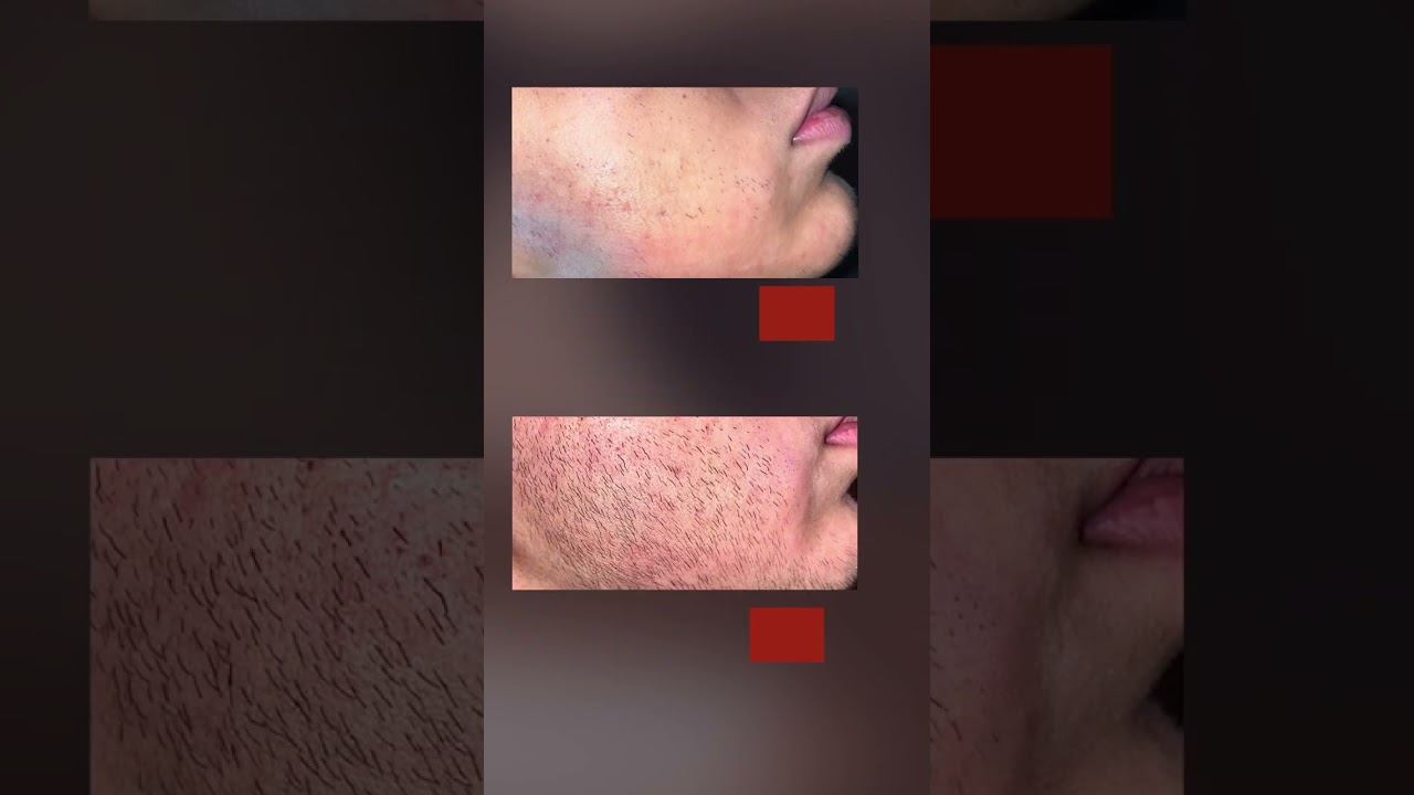 Мазал Mr.Volos и отрастил бороду за 3 месяца смотреть онлайн