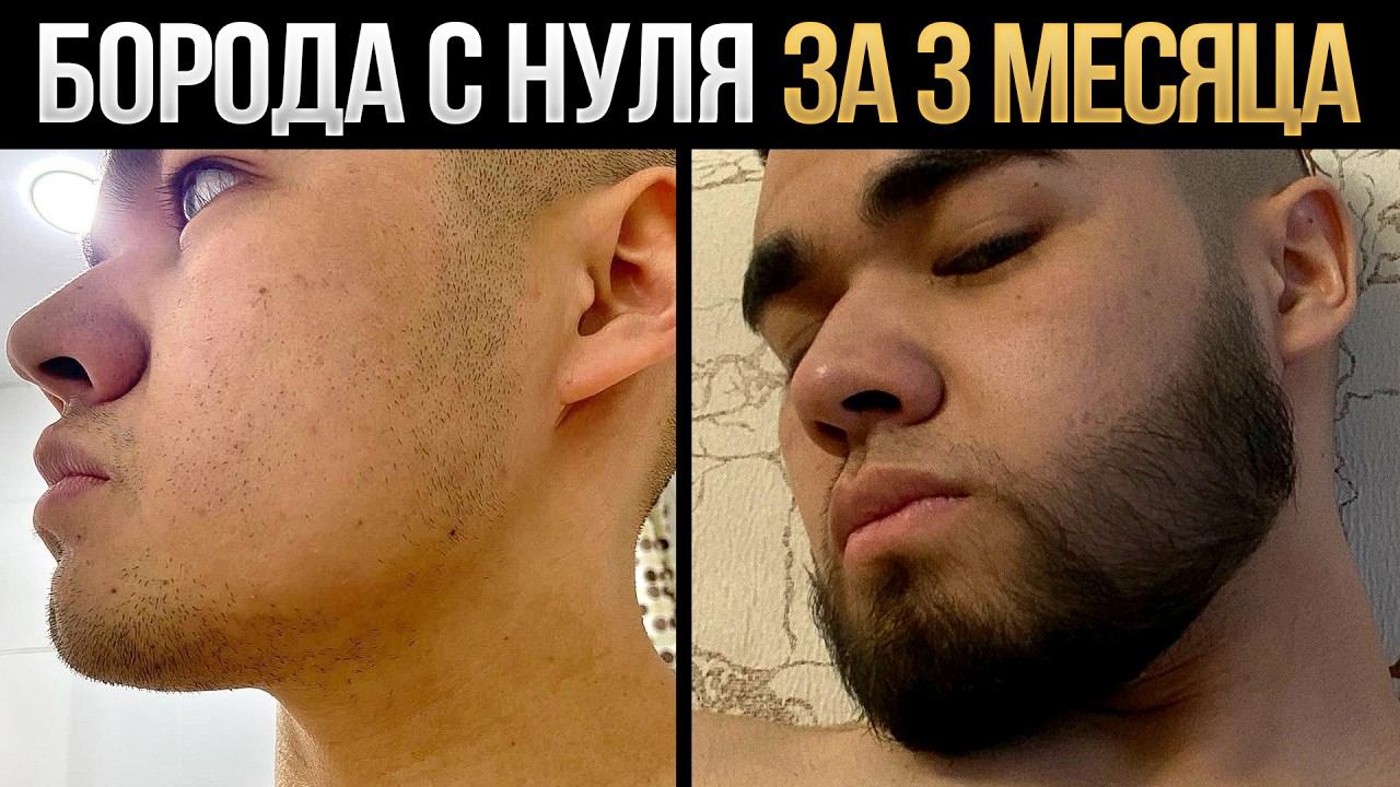 3 месяца наносил эти средства и отрастил бороду с нуля! смотреть онлайн