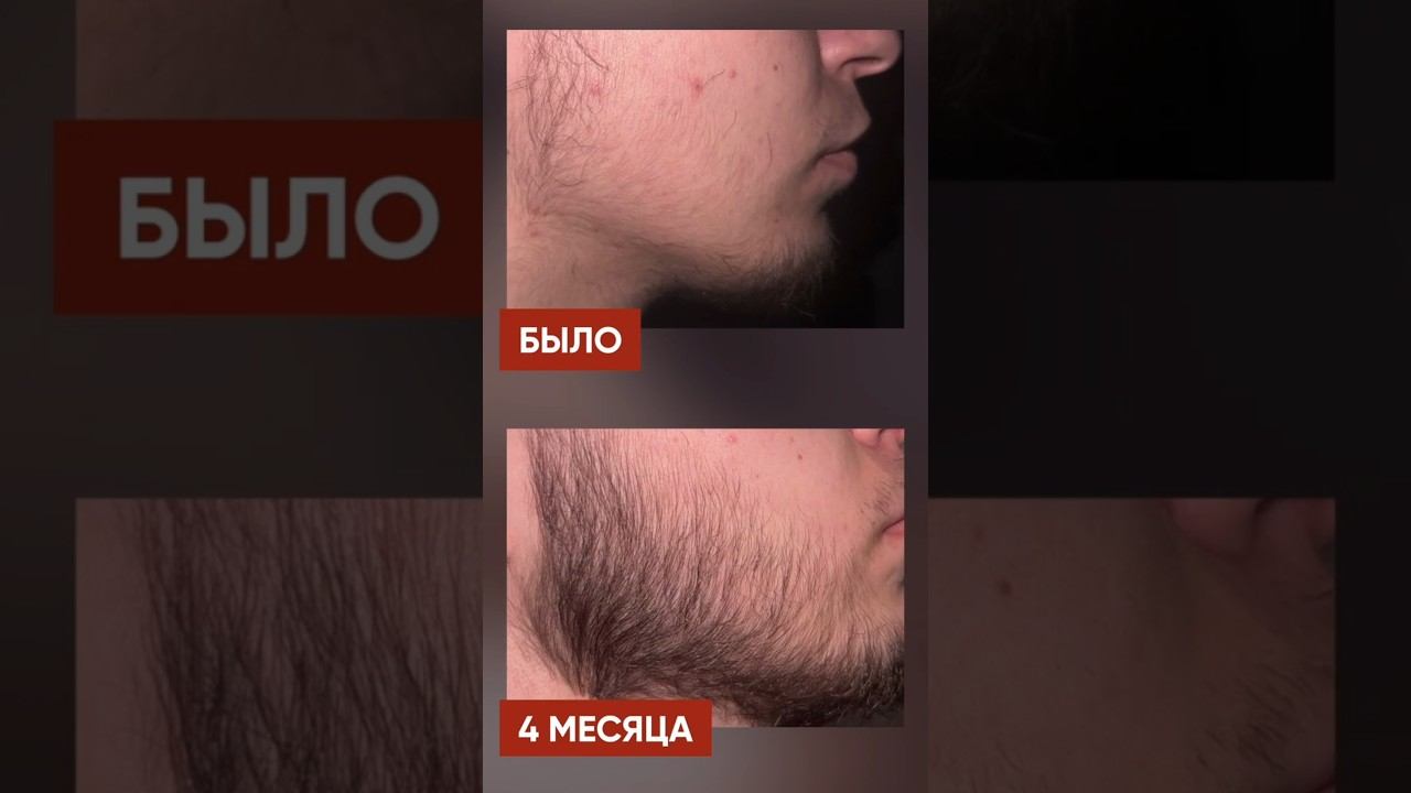 ОТРАСТИЛ БОРОДУ ЗА 4 МЕСЯЦА! смотреть онлайн