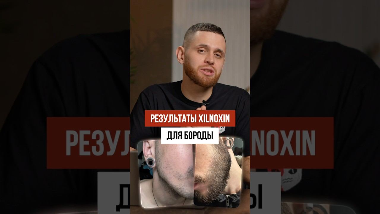 Как зарастить щеки, если не растет борода смотреть онлайн