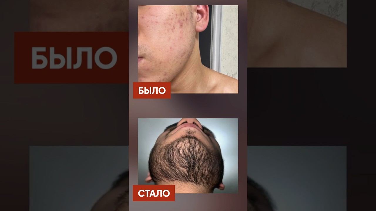 Какую бороду можно отрастить за 2,5 месяца? Результаты Киркланд смотреть онлайн