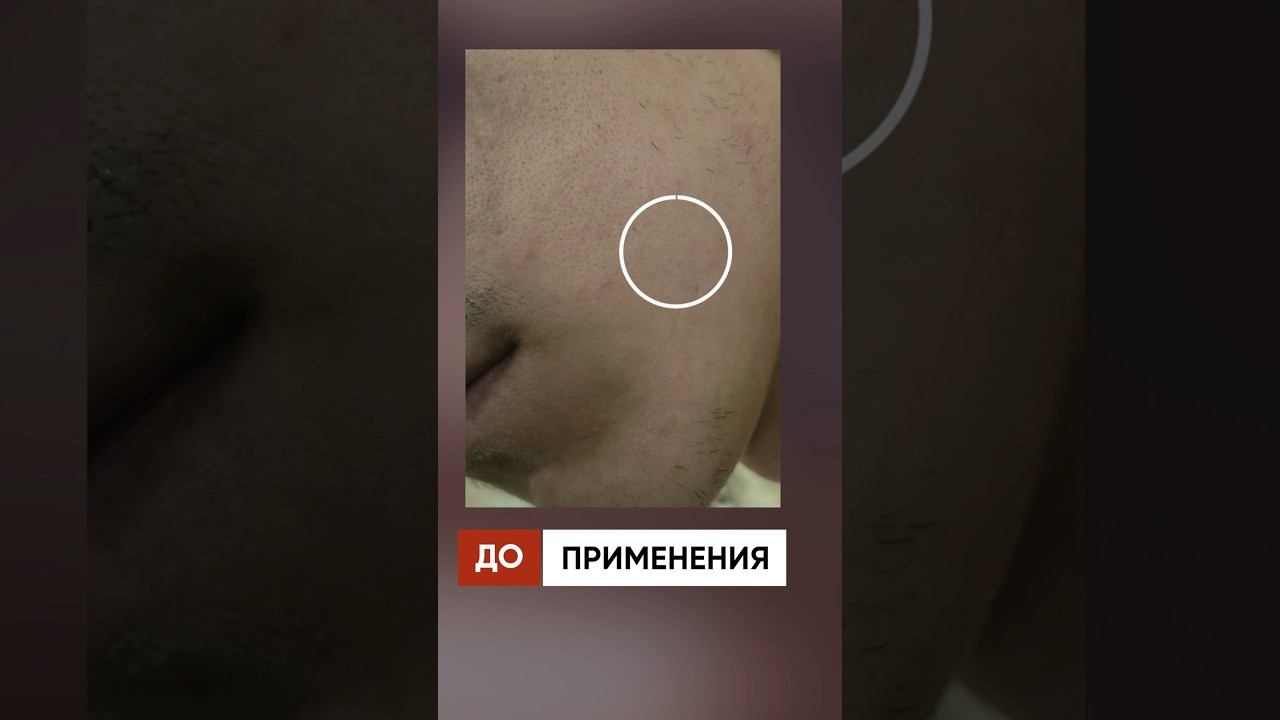 В 21 год росли только усы / Результаты mr.Volos для бороды смотреть онлайн