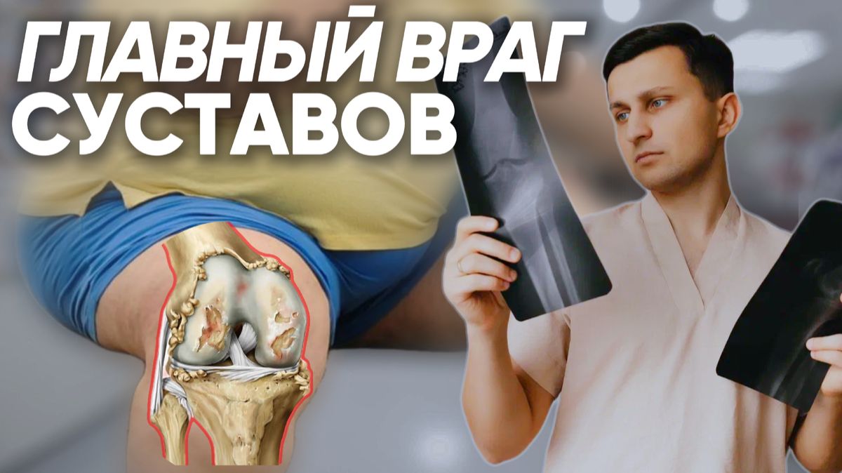 Как сохранить свои суставы на долгие годы и почему нужно худеть как можно раньше смотреть онлайн