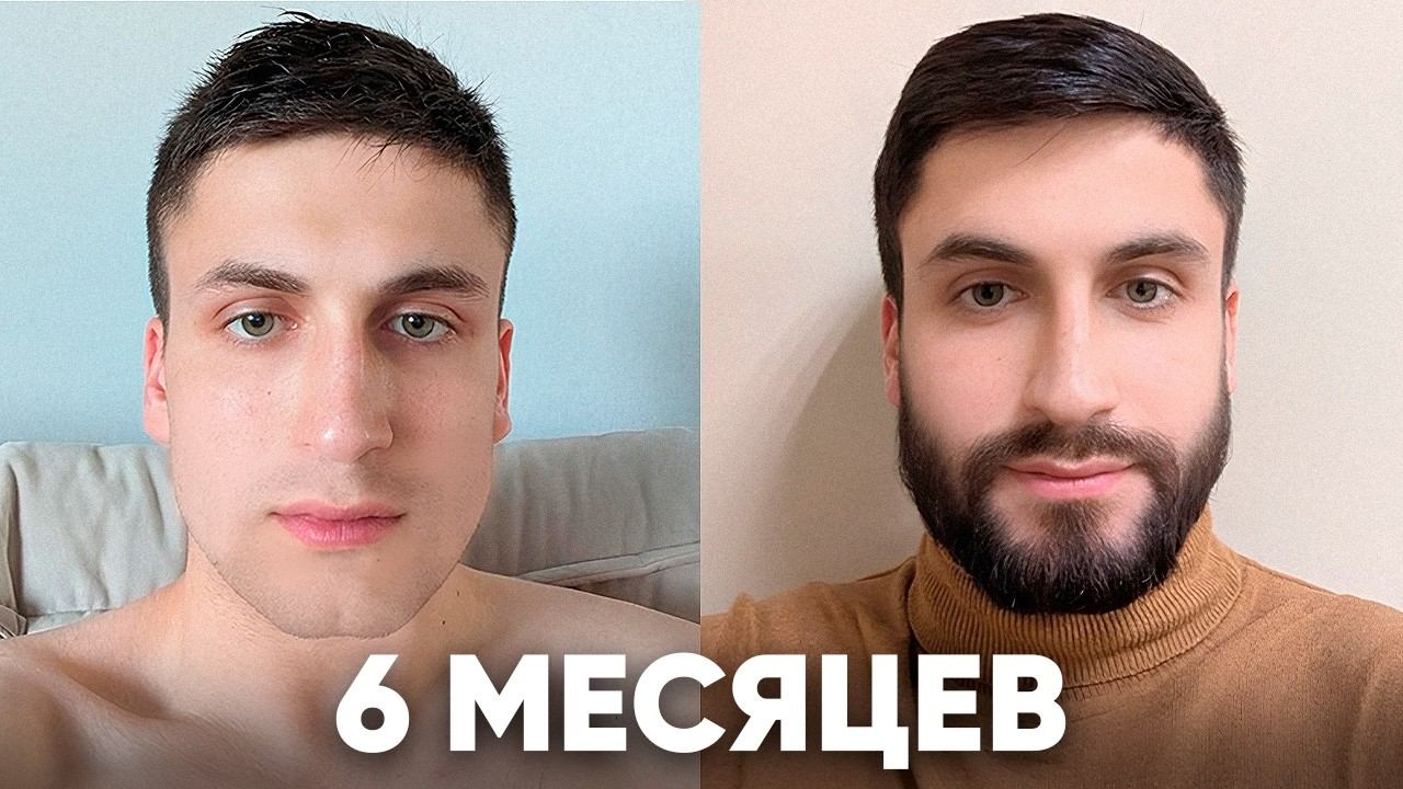 отрастил бороду мечты за 6 месяцев смотреть онлайн