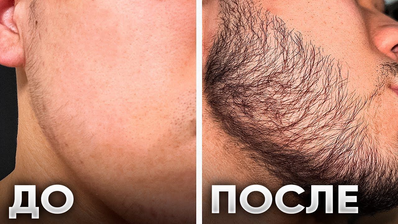 Отрастил ГОЛЛИВУДСКУЮ бороду за 2,5 месяца / результаты Киркланд смотреть онлайн