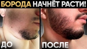 Не растёт борода? ПРОСТО ПОВТОРИ! Результаты средства для роста бороды за 4 месяца