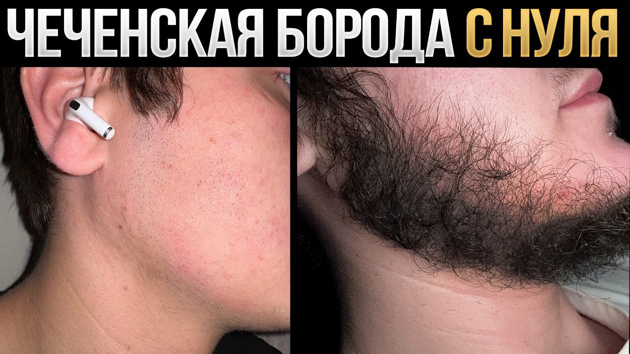 В 18 лет БОРОДА С НУЛЯ всего за 4 месяца / Результаты mr.Volos смотреть онлайн