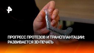 В РФ начали применять моделирование и 3D-печать в операциях по трансплантации