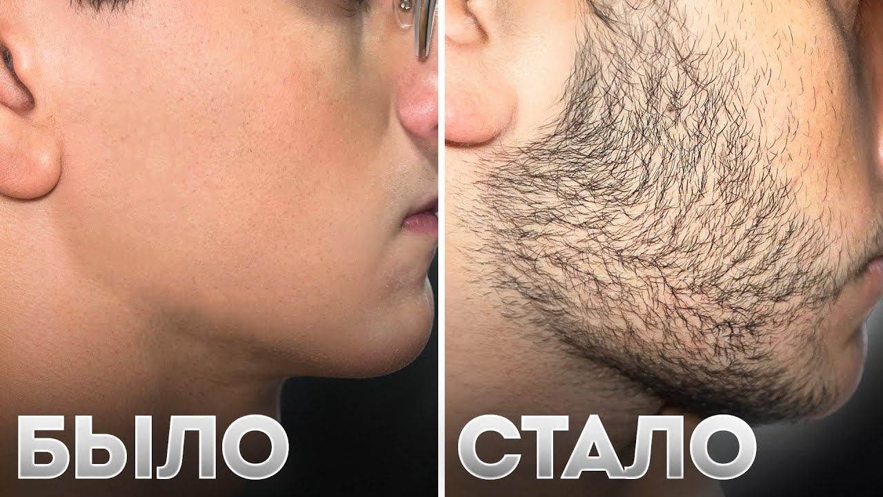 БОРОДА С НУЛЯ ЗА 3 МЕСЯЦА. РЕЗУЛЬТАТ Mr.VOLOS смотреть онлайн