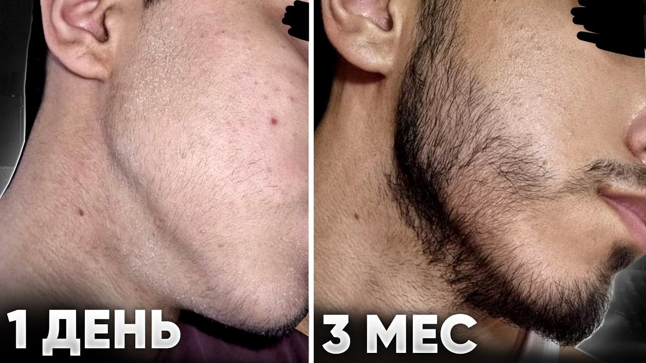 Запустил рост бороды с полного нуля. Помог этот лосьон для роста волос смотреть онлайн