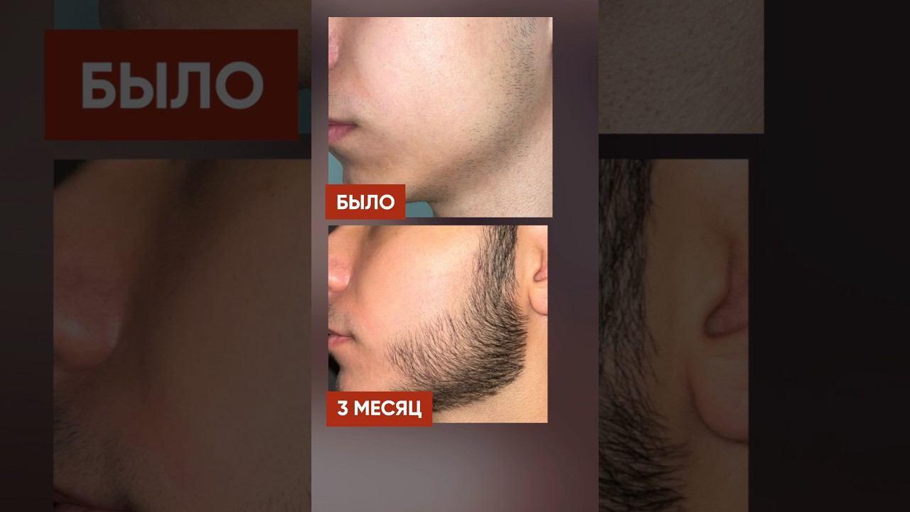 Лосьон для буста бороды. Всего 3 месяца смотреть онлайн