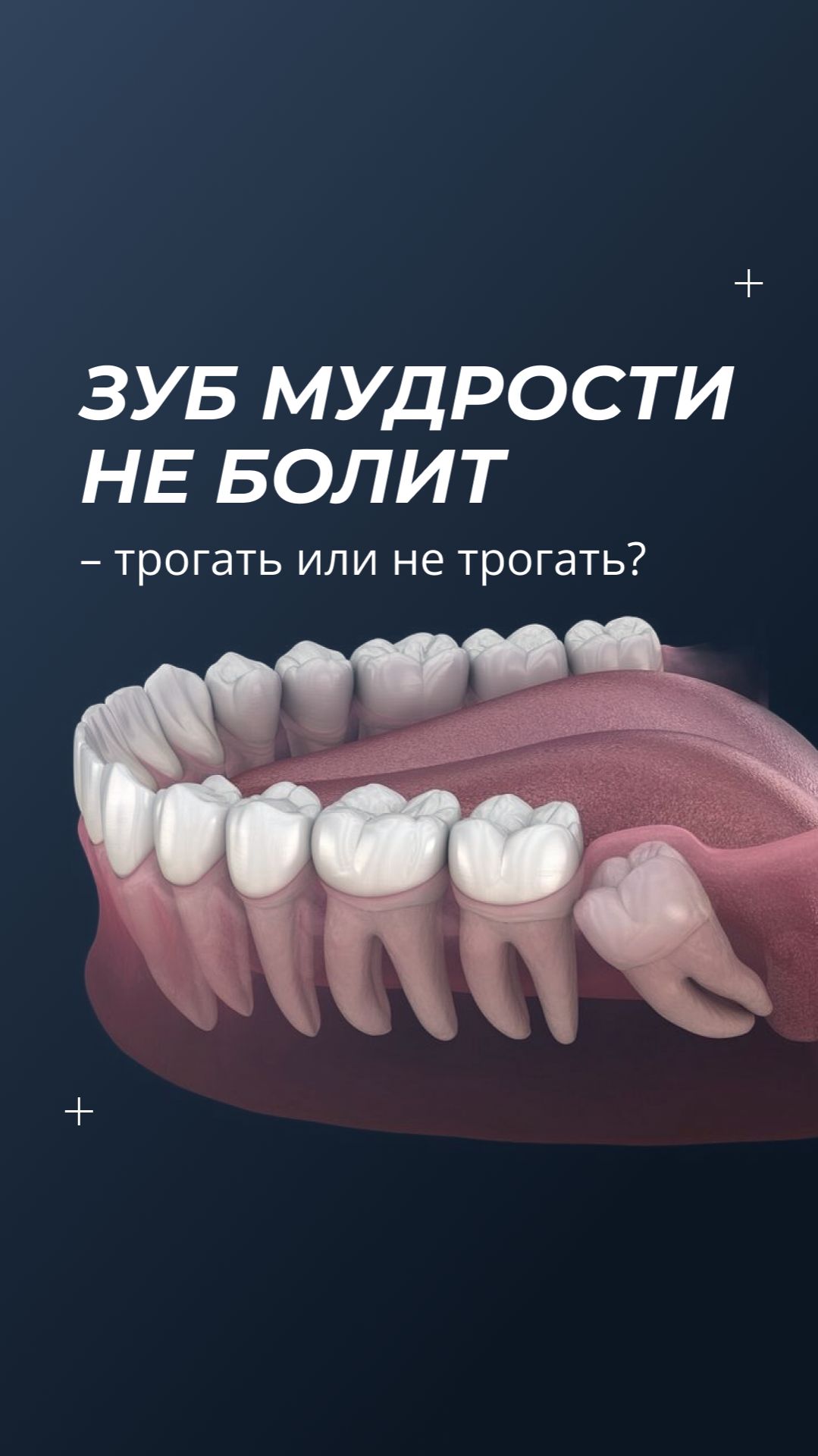 Зуб мудрости не болит  значит ли это что всё в порядке? shots